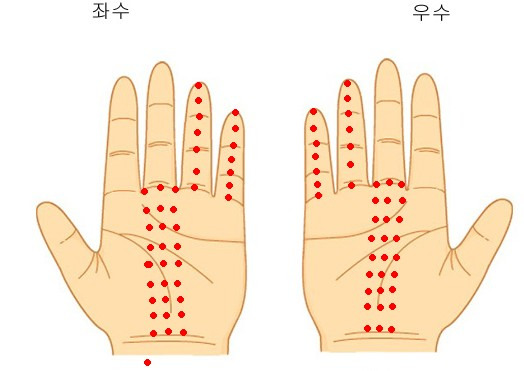 뜸 이미지
